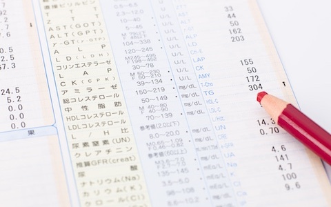豊富なオプション検査